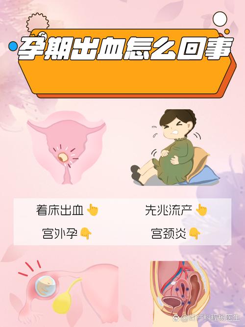 孕期见红不痛，需要立即就医吗？-第1张图片-中州医学会