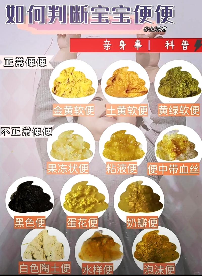 新生儿蛋花样大便是什么原因？-第1张图片-中州医学会