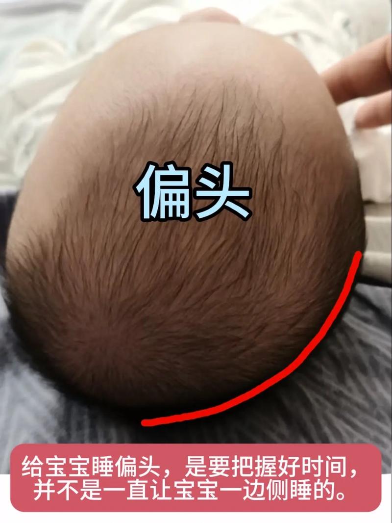 新生儿总侧头睡觉，需纠正吗？-第2张图片-中州医学会
