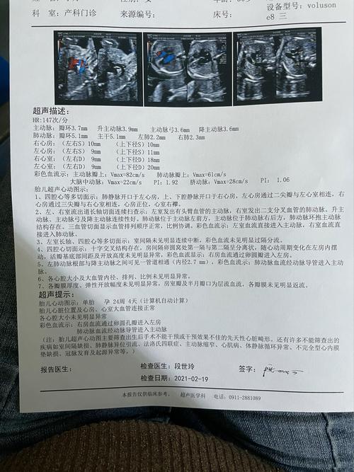 孕期心脏彩超能查出哪些胎儿问题？-第2张图片-中州医学会