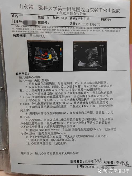 孕期心脏彩超能查出哪些胎儿问题？-第3张图片-中州医学会