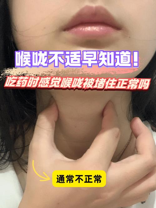 孕期喉咙有异物感是何原因？-第2张图片-中州医学会