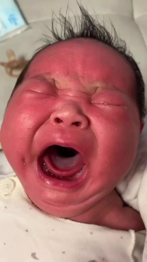 新生儿吃奶肚子咕噜响是正常现象吗？-第2张图片-中州医学会