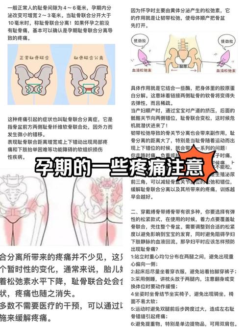 孕期屁股疼是啥原因？-第2张图片-中州医学会