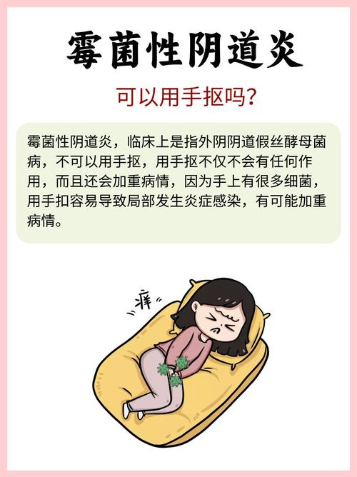 孕期霉菌性阴炎咋办？-第1张图片-中州医学会