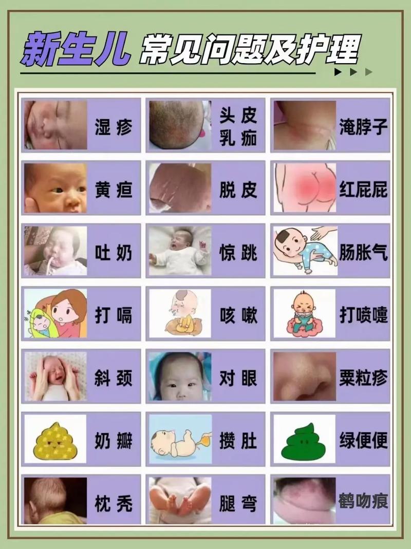 母体链球菌感染新生儿危害有多大？-第2张图片-中州医学会