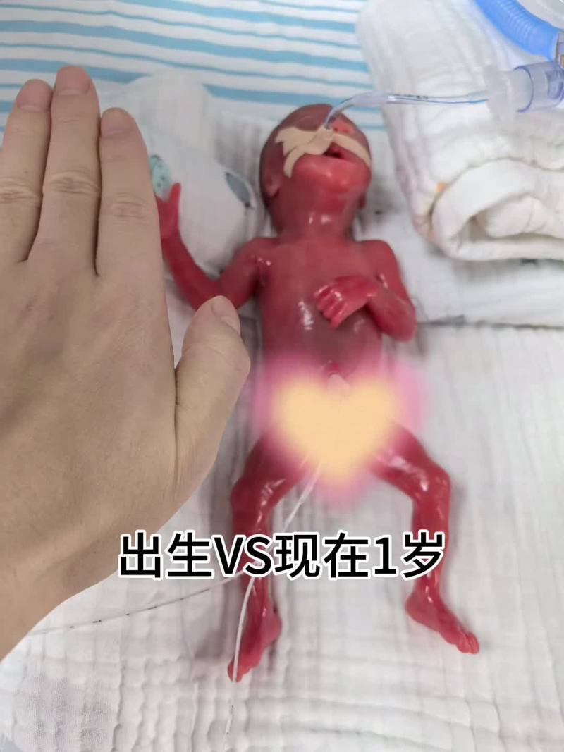 母体链球菌感染新生儿危害有多大？-第3张图片-中州医学会