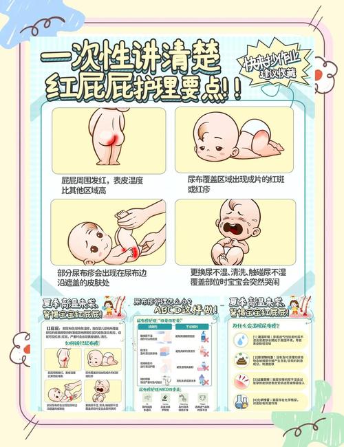 新生儿红臀咋回事？护理方法有啥讲究？-第1张图片-中州医学会
