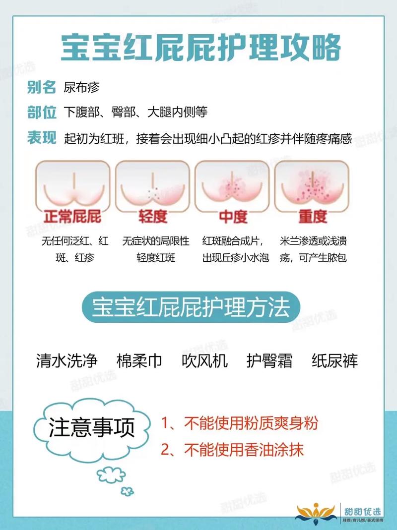 新生儿红臀咋回事？护理方法有啥讲究？-第2张图片-中州医学会