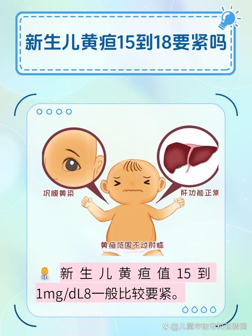 黄疸降了会反弹吗？-第3张图片-中州医学会