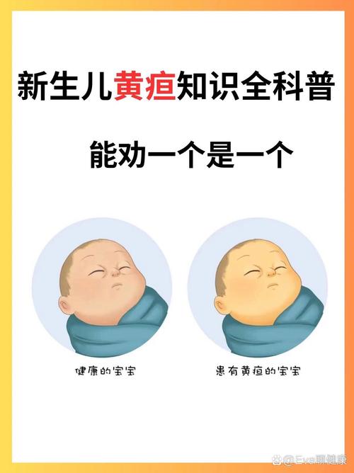 蚕豆病黄疸多高算超标？-第3张图片-中州医学会