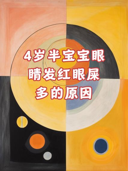 新生儿眼屎多,是上火还是生病了?-第2张图片-中州医学会 新生儿眼屎多,是上火还是生病了?-第2张图片-中州医学会