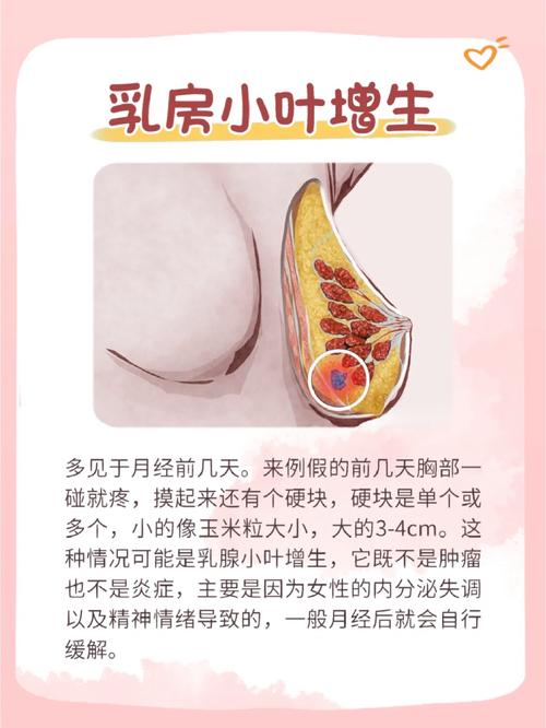 怀孕乳房硬块正常吗？需警惕吗？-第3张图片-中州医学会