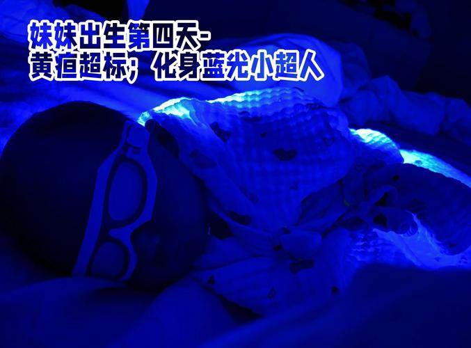 新生儿照蓝光伤眼睛吗？-第2张图片-中州医学会