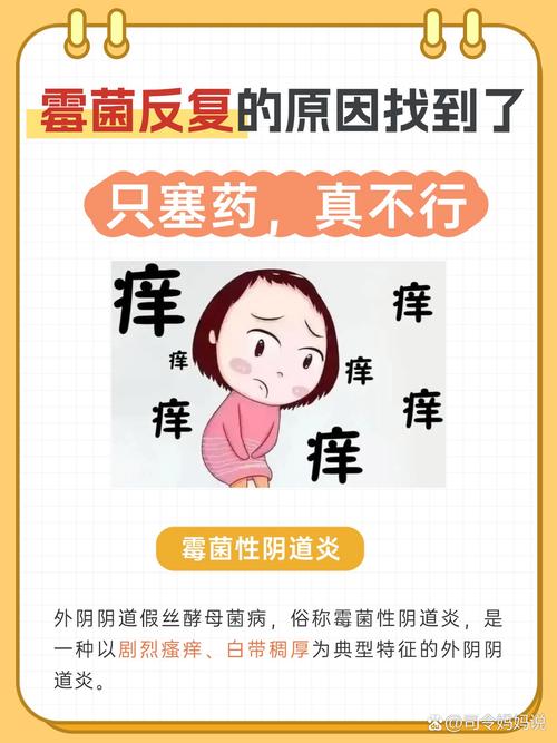 孕期霉菌性阴道炎如何安全应对？-第3张图片-中州医学会