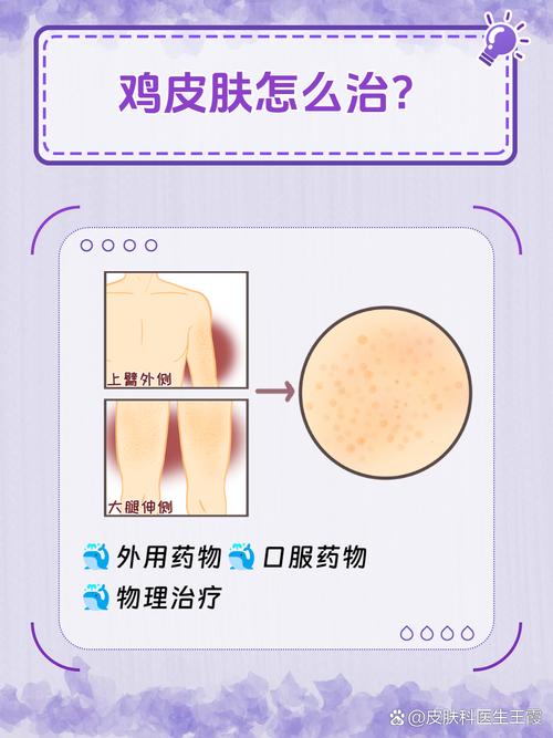 儿童皮肤像鸡皮怎么办？-第3张图片-中州医学会