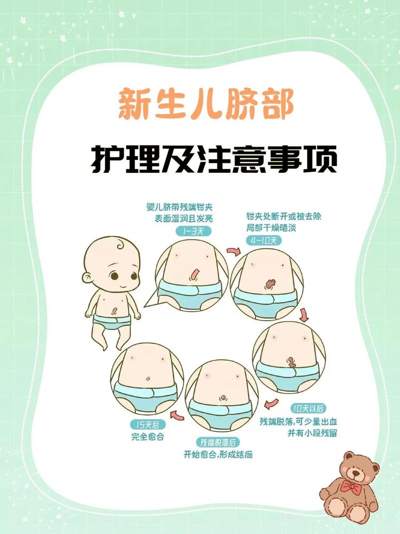 新生儿肚脐护理怎么做？视频教程教你！-第1张图片-中州医学会