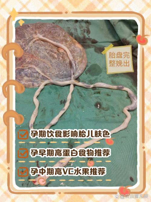 孕期吃什么真能让宝宝皮肤白吗?-第2张图片-中州医学会 孕期吃什么真能让宝宝皮肤白吗?-第2张图片-中州医学会