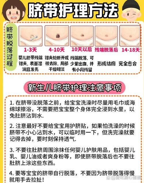 新生儿脐带何时脱落？-第2张图片-中州医学会
