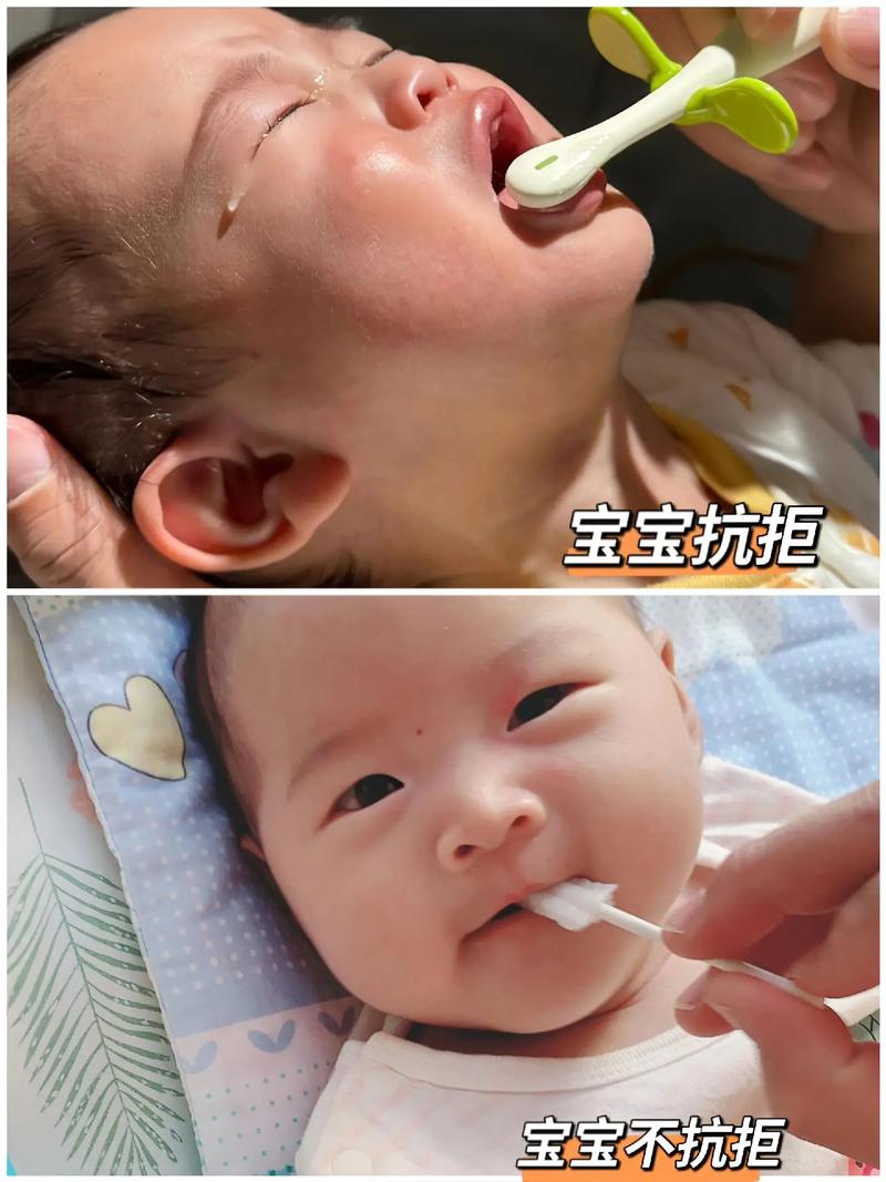 新生儿需清洁口腔舌苔吗？-第3张图片-中州医学会