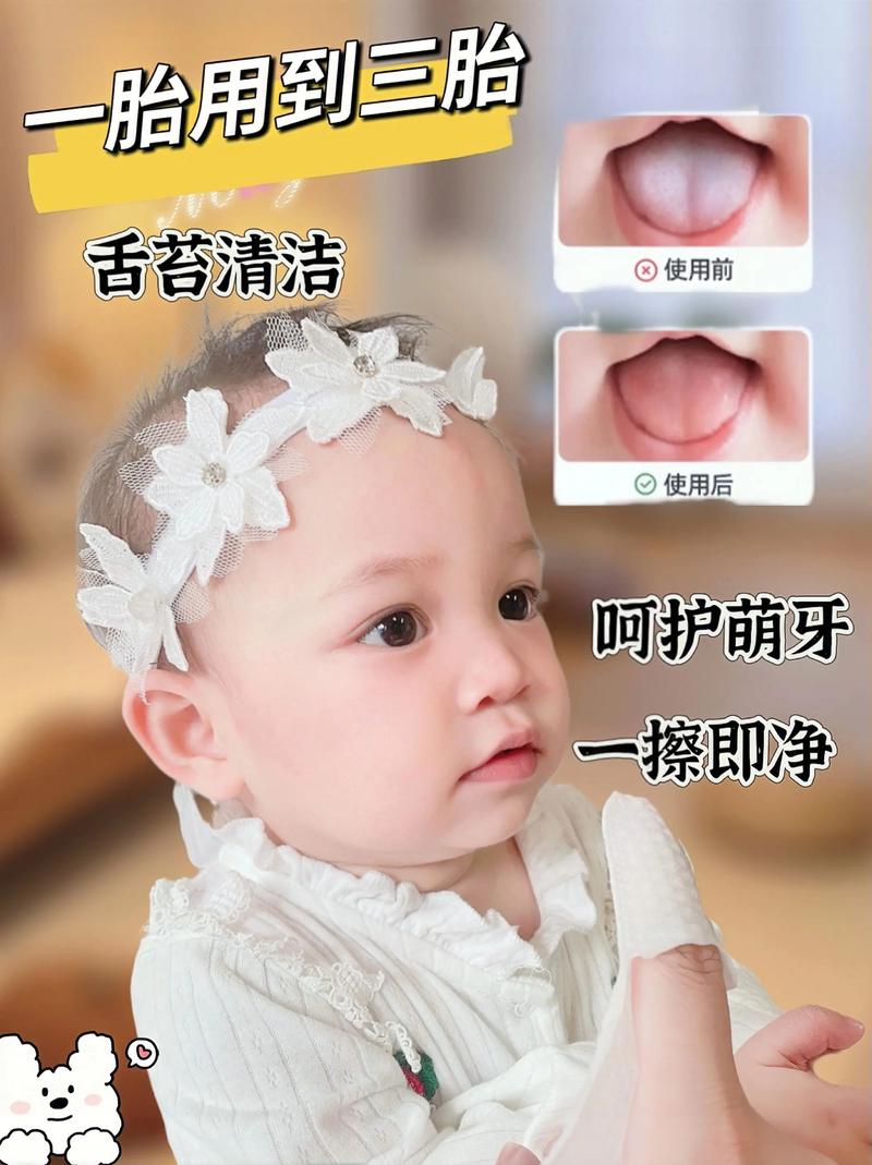 新生儿需清洁口腔舌苔吗？-第1张图片-中州医学会
