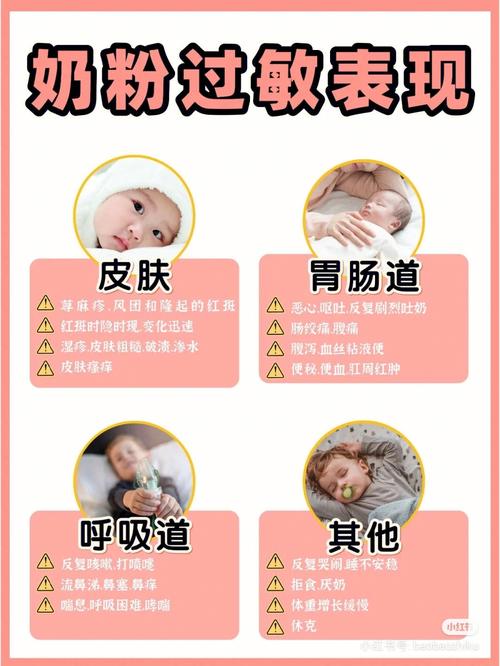 新生儿奶粉过敏有哪些症状？-第1张图片-中州医学会