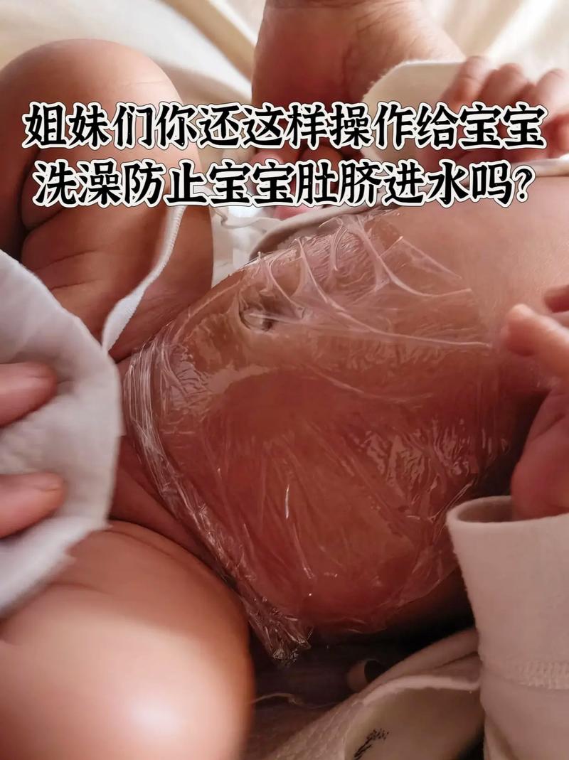 新生儿肚脐脱落后能洗澡吗？-第2张图片-中州医学会
