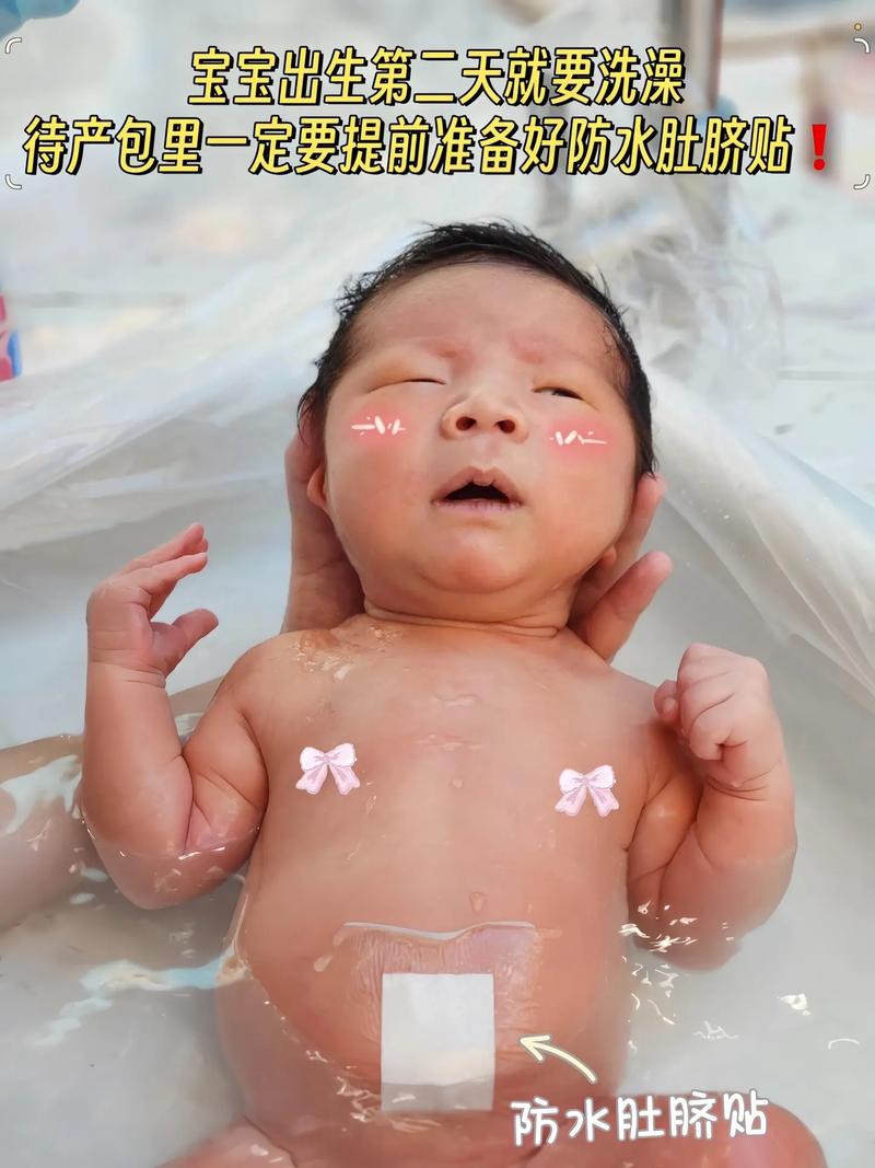 新生儿肚脐脱落后能洗澡吗？-第1张图片-中州医学会