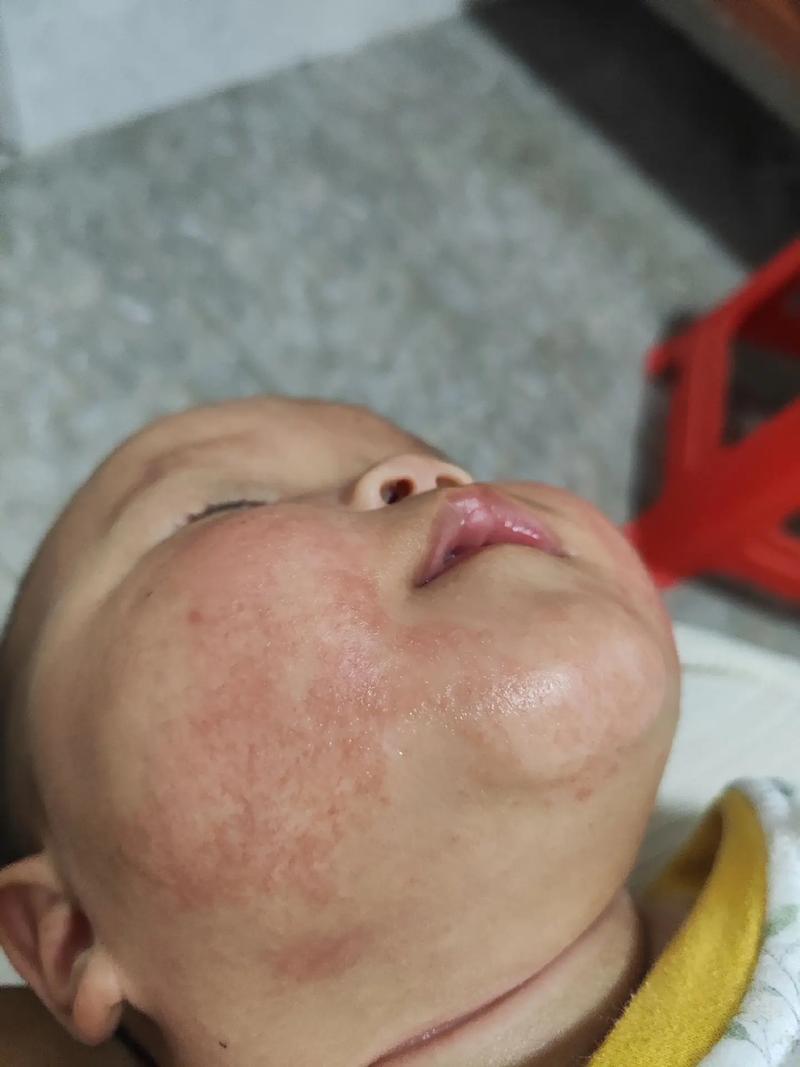 新生儿两边脸不一样大怎么办？-第2张图片-中州医学会