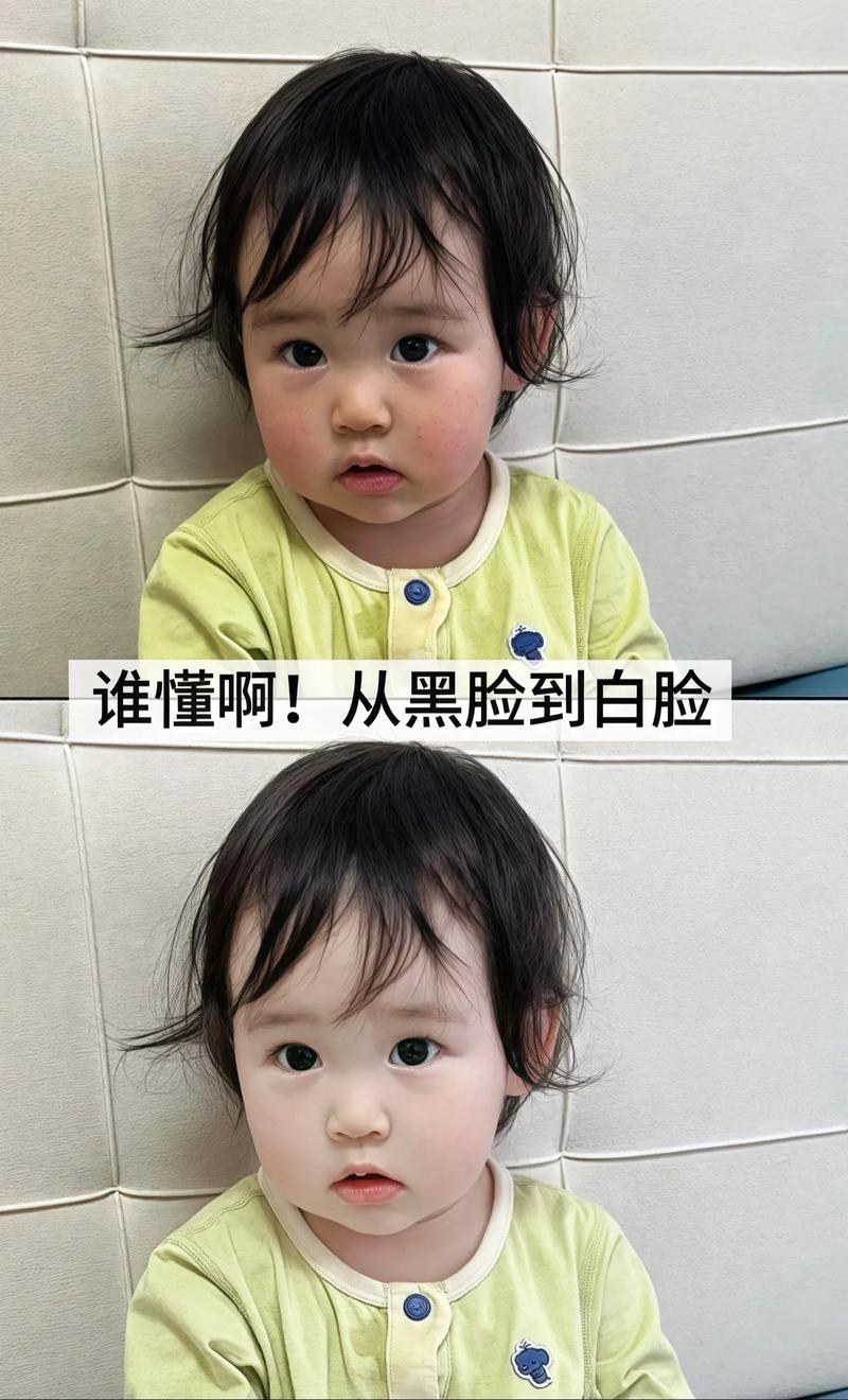 新生儿两边脸不一样大怎么办？-第3张图片-中州医学会