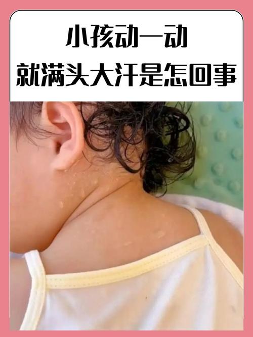 孩子一动就出汗,是体虚还是疾病?-第1张图片-中州医学会 孩子一动就出汗,是体虚还是疾病?-第1张图片-中州医学会