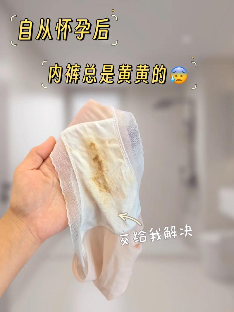 孕期内裤见血是何原因？-第1张图片-中州医学会