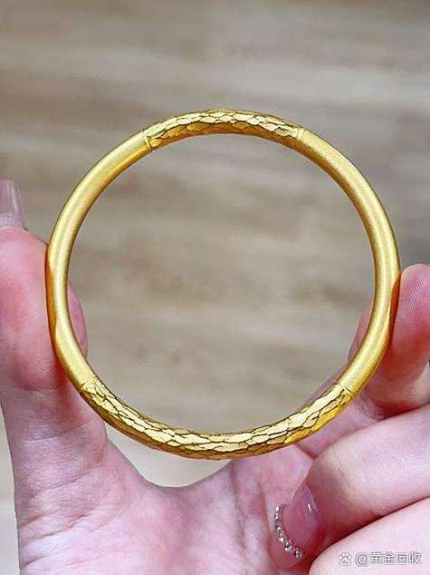 孕期能戴金银首饰吗？-第1张图片-中州医学会