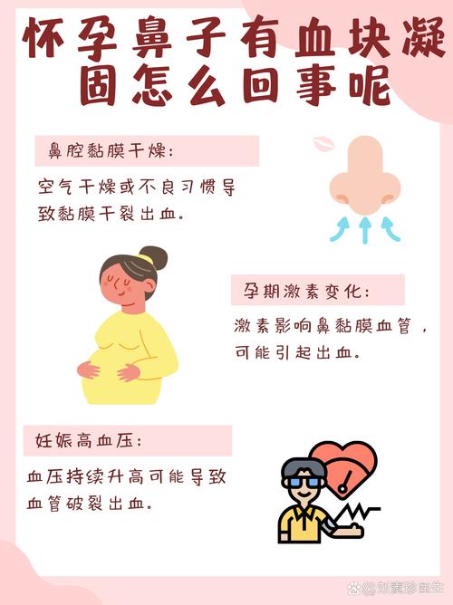 孕期流鼻血是何原因？-第1张图片-中州医学会