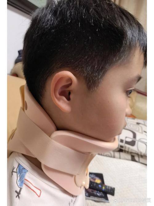 儿童寰枢椎半脱位能自愈吗?-第2张图片-中州医学会 儿童寰枢椎半脱位能自愈吗?-第2张图片-中州医学会