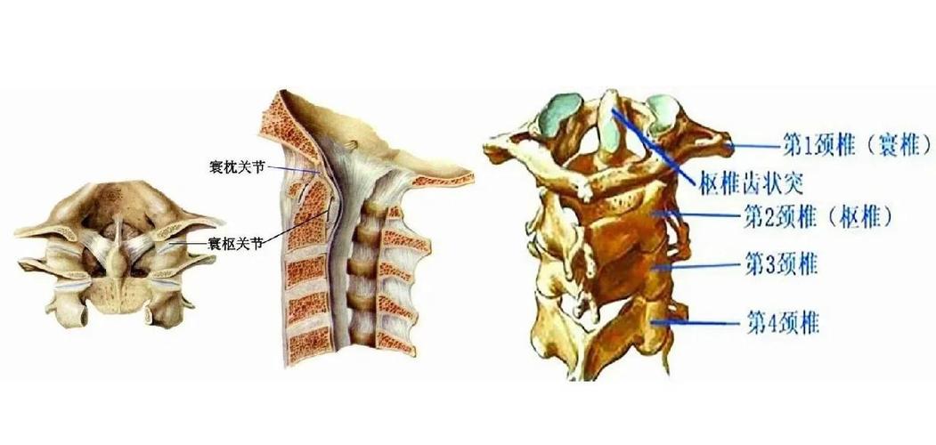 儿童寰枢椎半脱位能自愈吗?-第3张图片-中州医学会 儿童寰枢椎半脱位能自愈吗?-第3张图片-中州医学会
