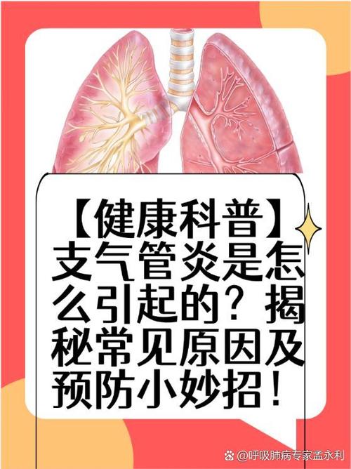 新生儿支气管炎和肺炎如何区分？-第3张图片-中州医学会