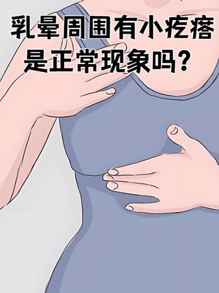 孕期乳晕小肉粒是何原因？-第3张图片-中州医学会