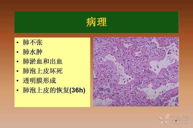 新生儿肺透明膜病有哪些典型临床表现？-第2张图片-中州医学会