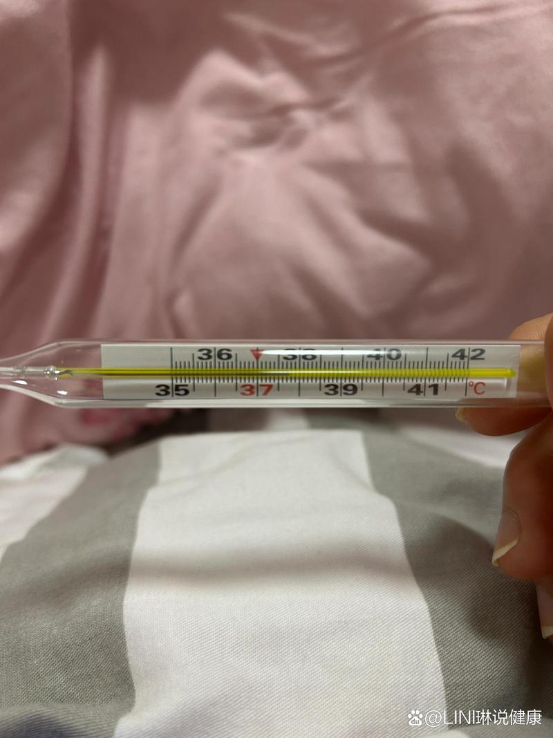 孕期37℃算发烧吗？-第1张图片-中州医学会