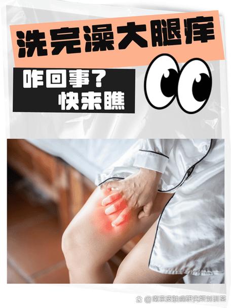 孕期腿痒怎么办?-第1张图片-中州医学会 孕期腿痒怎么办?-第1张图片-中州医学会