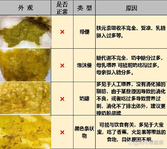 新生儿大便怎样才算正常？-第1张图片-中州医学会