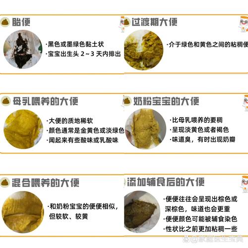 新生儿大便怎样才算正常？-第3张图片-中州医学会