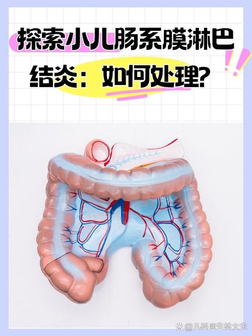 儿童腹腔淋巴结肿大，咋办？-第3张图片-中州医学会