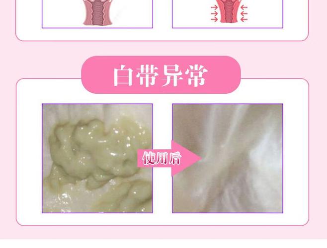 孕期阴道异味是何原因导致？-第3张图片-中州医学会