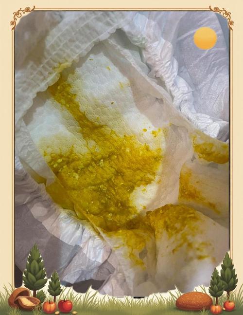 新生儿拉黄屎带奶瓣正常吗？-第2张图片-中州医学会