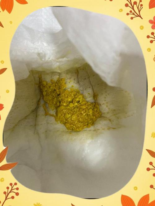 新生儿拉黄屎带奶瓣正常吗？-第1张图片-中州医学会