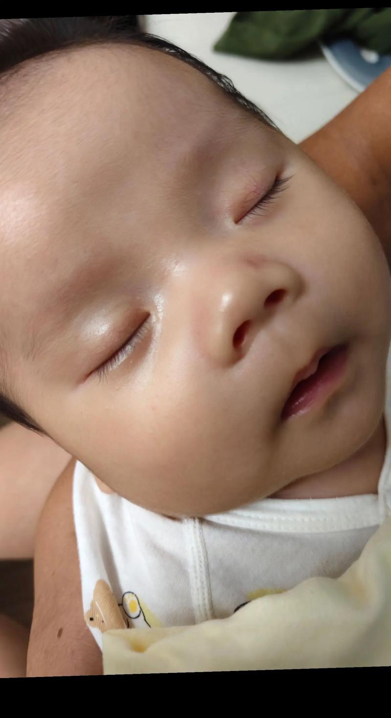 新生儿眼红血丝正常吗？-第1张图片-中州医学会