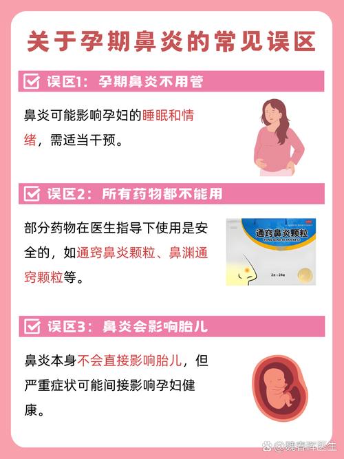 孕期鼻炎什么症状是什么-第3张图片-中州医学会