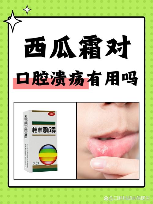 儿童口腔溃疡能用西瓜霜吗？-第1张图片-中州医学会